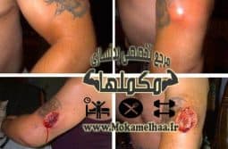 steroid37L استروئیدها و عوارض جانبی آنها قسمت سوم