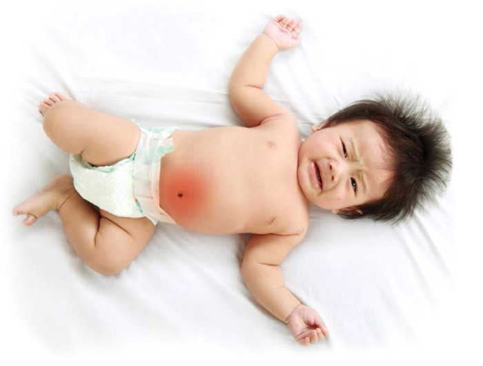 فواید پروبیوتیک در نوزاد