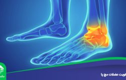 تقویت عضلات مچ پا