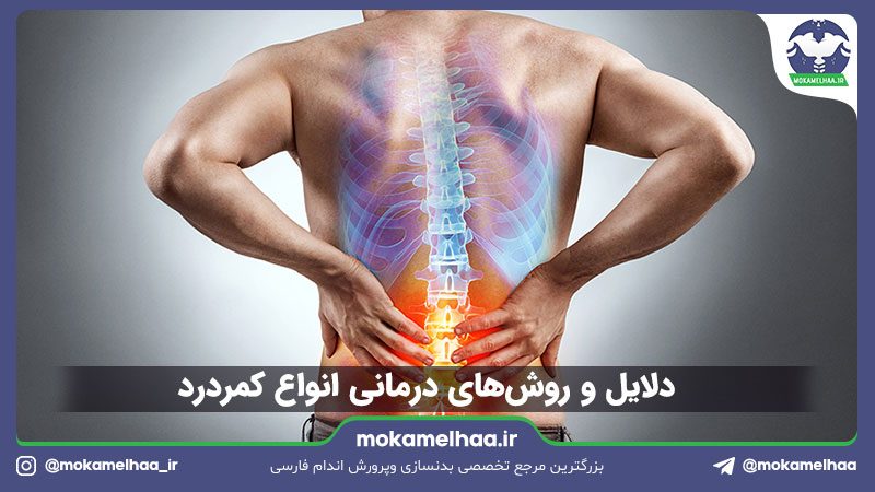 درمان کمردرد